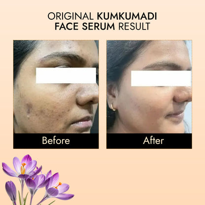 Original Kumkumadi Face Serum