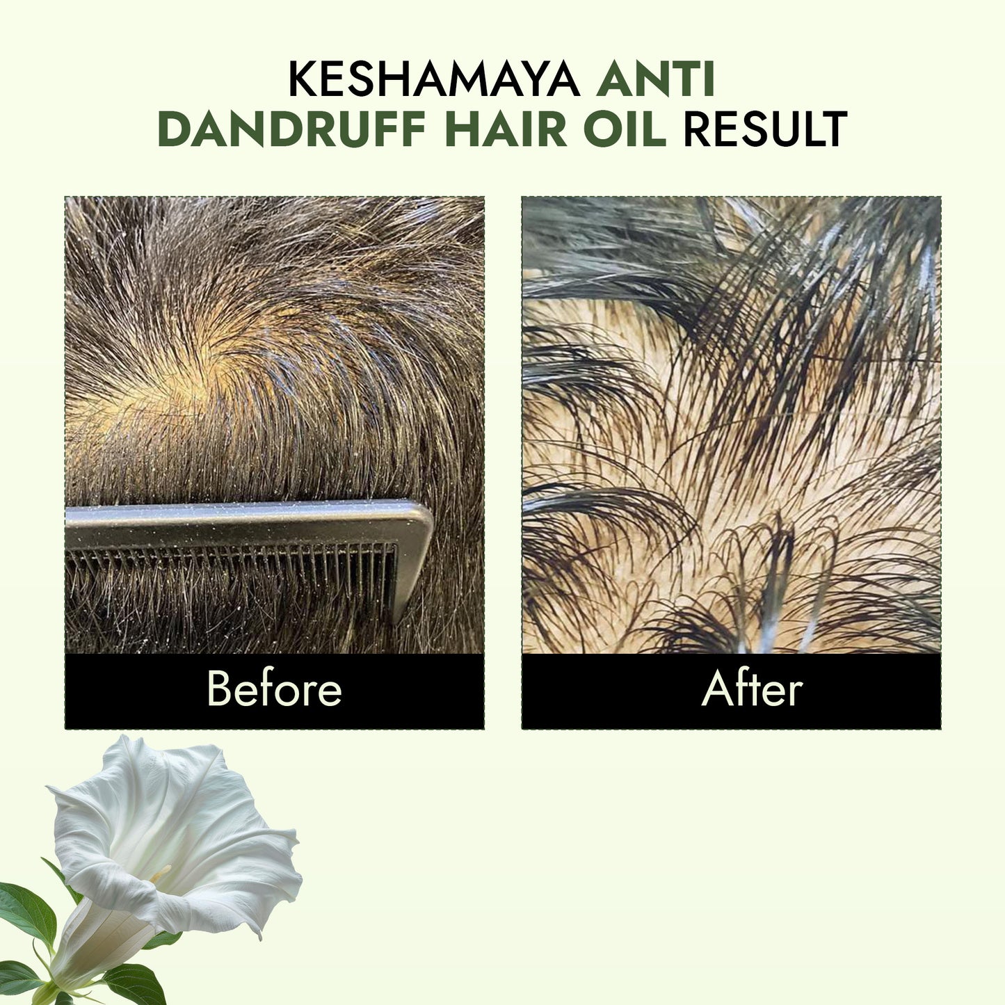 Keshamaya - Anti Dandruff Hair Oil