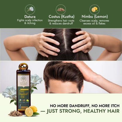 Keshamaya - Anti Dandruff Hair Oil